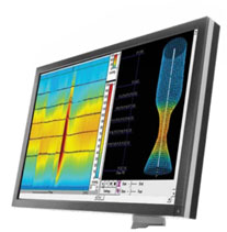 Anorectal Manometry